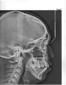 xray