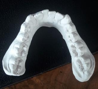 lower arch