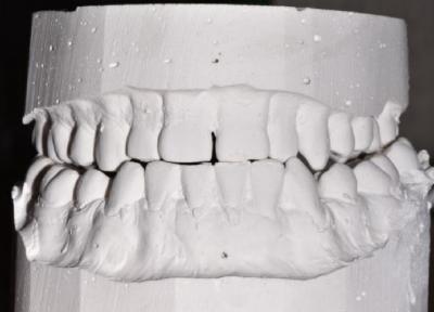 pr3 resize 24