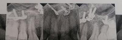 xray