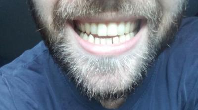 bite