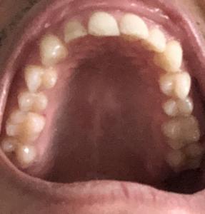 65451815 BCC3 475B B5A4 44264796C373