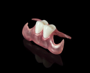 valplast denture