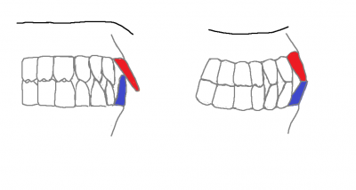 teeth contact