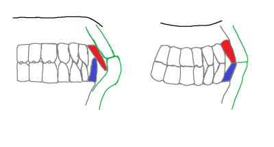 teeth contact