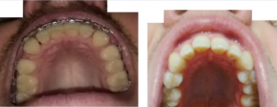 Comparison