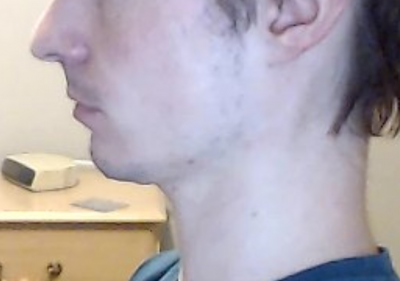 Jawline 26