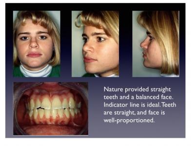 Proper Facial Growth