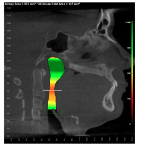 Screen Shot 2021 01 28 at 22.36.16