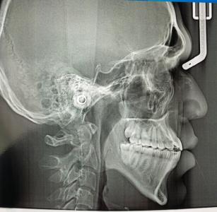 xray