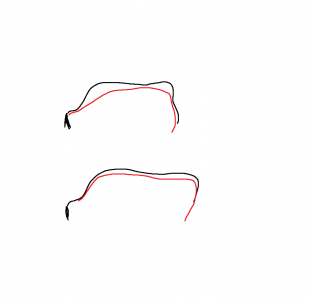 TONGUE POSTURE